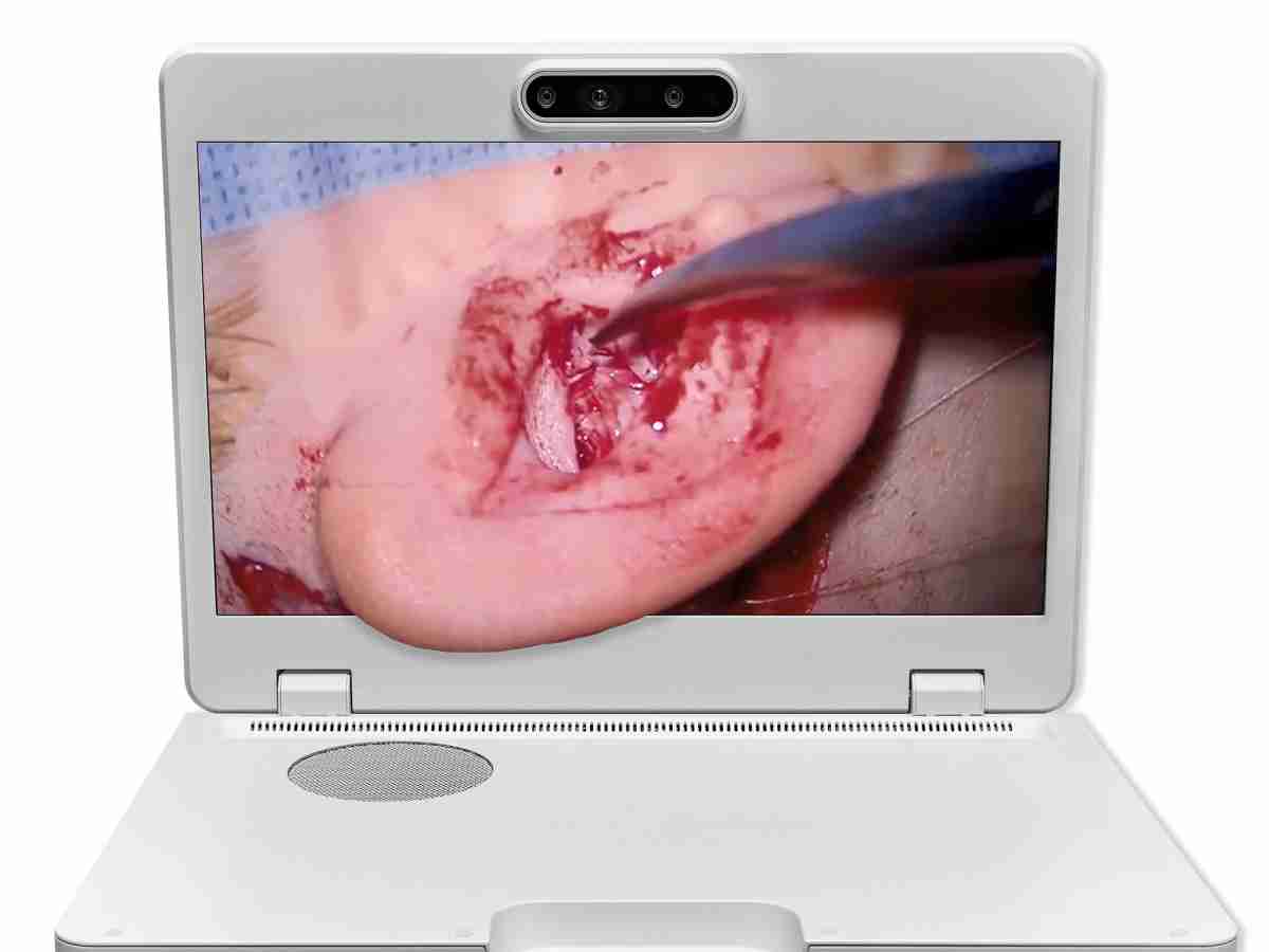 达擎之＂Heads-up 3D显微手术显示系统＂，，整合4K裸眼3D显示及眼球追踪系统，，，具备快速追踪人眼移动位置功能，，减轻医师长时间维持固定姿势的负担，，让医师能有更宽广清晰的3D立体视野及更舒适的姿势来执行手术。。。。